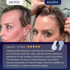 Suero para el Crecimiento del Cabello