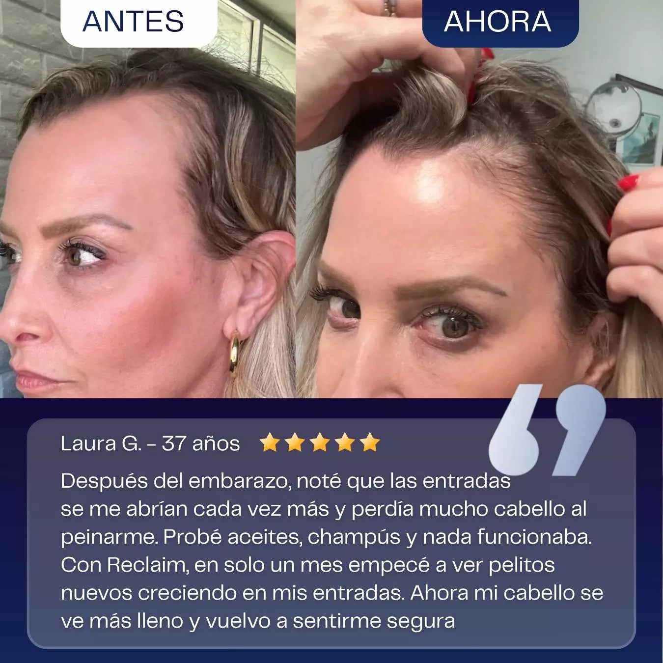 Suero para el Crecimiento del Cabello